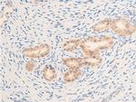 Phospho-EGFR (Ser1071) Antibody in Immunohistochemistry (Paraffin) (IHC (P))