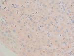 Phospho-c-Fos (Ser362) Polyclonal Antibody