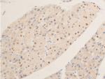 Phospho-c-Myc (Ser62) Antibody in Immunohistochemistry (Paraffin) (IHC (P))