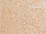 Phospho-c-Myc (Thr58) Antibody in Immunohistochemistry (Paraffin) (IHC (P))