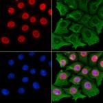 Phospho-C-RAF (Ser338) Polyclonal Antibody