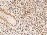 Phospho-Glucocorticoid Receptor (Ser203) Polyclonal Antibody
