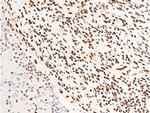 Phospho-Glucocorticoid Receptor (Ser203) Antibody in Immunohistochemistry (Paraffin) (IHC (P))
