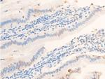 Phospho-Glucocorticoid Receptor (Ser203) Antibody in Immunohistochemistry (Paraffin) (IHC (P))