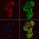 Phospho-ErbB2 (HER-2) (Tyr877) Polyclonal Antibody