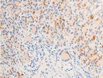 Phospho-ErbB2 (HER-2) (Tyr877) Antibody in Immunohistochemistry (Paraffin) (IHC (P))