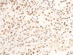 Phospho-TrkA (Tyr680, Tyr681) Polyclonal Antibody