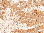 Phospho-p53 (Ser15) Antibody in Immunohistochemistry (Paraffin) (IHC (P))