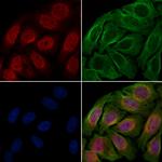 Phospho-p53 (Ser46) Antibody in Immunocytochemistry (ICC/IF)