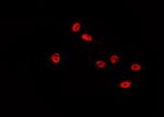 Phospho-p53 (Ser46) Antibody in Immunocytochemistry (ICC/IF)