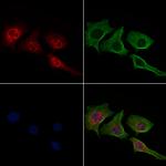 Phospho-c-Jun (Thr91) Polyclonal Antibody