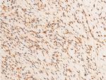 Phospho-c-Jun (Thr93) Antibody in Immunohistochemistry (Paraffin) (IHC (P))
