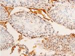 Phospho-c-Jun (Tyr170) Polyclonal Antibody