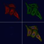 Phospho-INSR (Tyr1355) Polyclonal Antibody