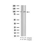 Phospho-INSR (Tyr1361) Antibody in Western Blot (WB)