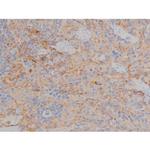 Phospho-Fyn (Tyr531) Antibody in Immunohistochemistry (Paraffin) (IHC (P))