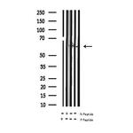 Phospho-Tyrosine Hydroxylase (Ser19) Antibody in Western Blot (WB)