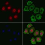 Phospho-Tyrosine Hydroxylase (Ser31) Polyclonal Antibody