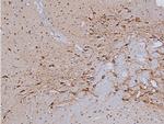 Phospho-Tyrosine Hydroxylase (Ser31) Antibody in Immunohistochemistry (Paraffin) (IHC (P))