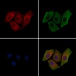 Phospho-RET (Tyr1062) Polyclonal Antibody