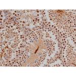 Phospho-SP1 (Thr453) Antibody in Immunohistochemistry (Paraffin) (IHC (P))