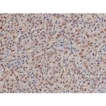 Phospho-SP1 (Thr453) Antibody in Immunohistochemistry (Paraffin) (IHC (P))