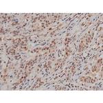Phospho-SP1 (Thr453) Antibody in Immunohistochemistry (Paraffin) (IHC (P))