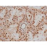 Phospho-SP1 (Thr453) Antibody in Immunohistochemistry (Paraffin) (IHC (P))