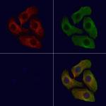 Phospho-IGF1R (Tyr1165, Tyr1166) Antibody in Immunocytochemistry (ICC/IF)
