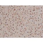 Phospho-IGF1R (Tyr1346) Antibody in Immunohistochemistry (Paraffin) (IHC (P))