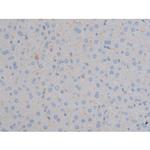 Phospho-IGF1R (Tyr1161) Polyclonal Antibody