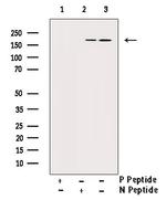 Phospho-PDGFRB (Tyr740) Antibody in Western Blot (WB)
