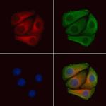 Phospho-PDGFRb (Tyr771) Polyclonal Antibody