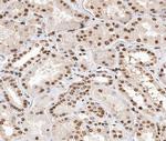 Phospho-Histone H2A (Thr121) Polyclonal Antibody