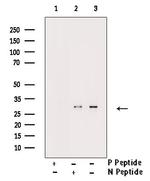 Phospho-BCL-2 (Ser87) Antibody in Western Blot (WB)