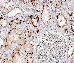 Phospho-BCL-2 (Thr69) Antibody in Immunohistochemistry (Paraffin) (IHC (P))