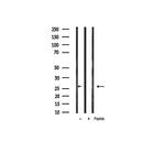 Phospho-BCL-2 (Thr69) Antibody in Western Blot (WB)