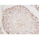 Phospho-Tau (Ser235) Antibody in Immunohistochemistry (Paraffin) (IHC (P))