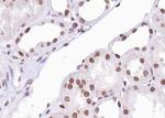 Phospho-ATF2 (Ser112, Ser94) Polyclonal Antibody