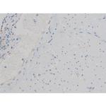 Phospho-ATF2 (Thr71, Thr53) Polyclonal Antibody