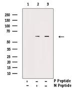 Phospho-CD19 (Tyr531) Antibody in Western Blot (WB)