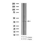 Phospho-RPA32 (Thr21) Antibody in Western Blot (WB)