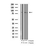 Phospho-CD44 (Ser706) Antibody in Western Blot (WB)