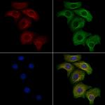 Phospho-CD31 (Tyr713) Antibody in Immunocytochemistry (ICC/IF)