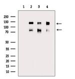 Phospho-CD31 (Tyr713) Antibody in Western Blot (WB)