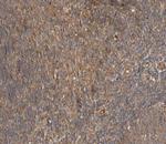 Phospho-PLCG2 (Tyr753) Antibody in Immunohistochemistry (Paraffin) (IHC (P))