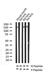 Phospho-PLCG2 (Tyr753) Antibody in Western Blot (WB)