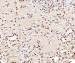 Phospho-Stathmin 1 (Ser38) Polyclonal Antibody