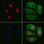 Phospho-JunB (Ser259) Antibody in Immunocytochemistry (ICC/IF)