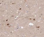 Phospho-JunB (Ser259) Antibody in Immunohistochemistry (Paraffin) (IHC (P))